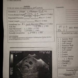 Abortion Papers
