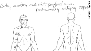 140818000822-brown-autopsy-diagram-story-body